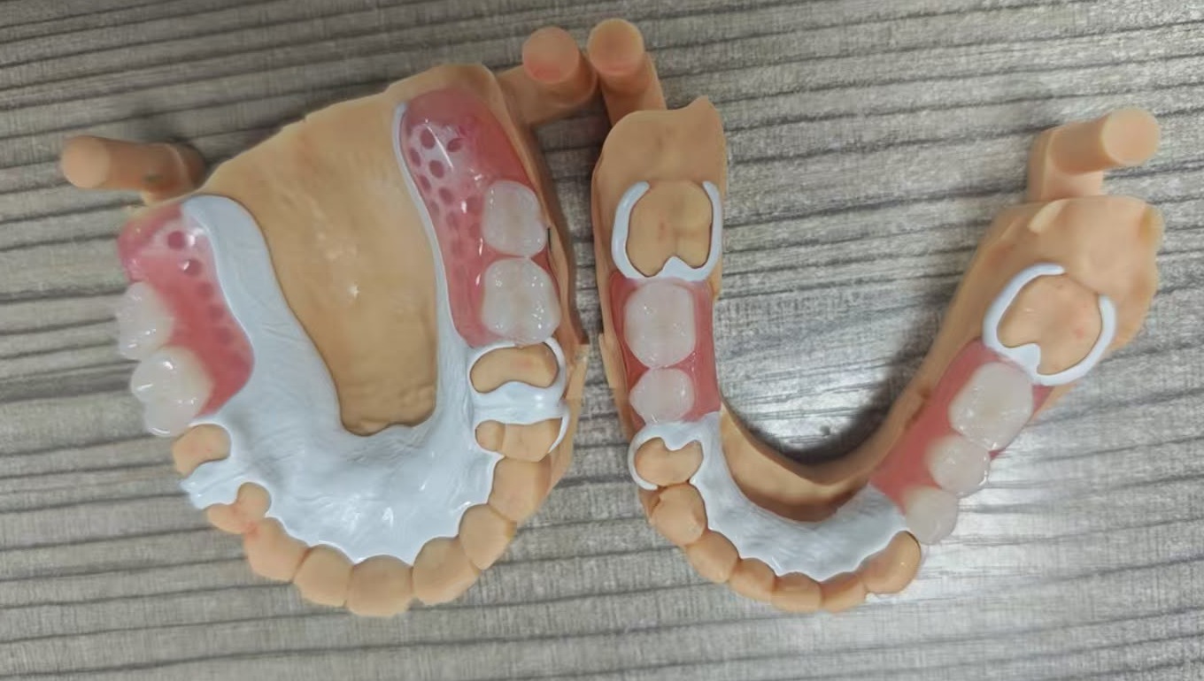 Removable frameworks shown on working models